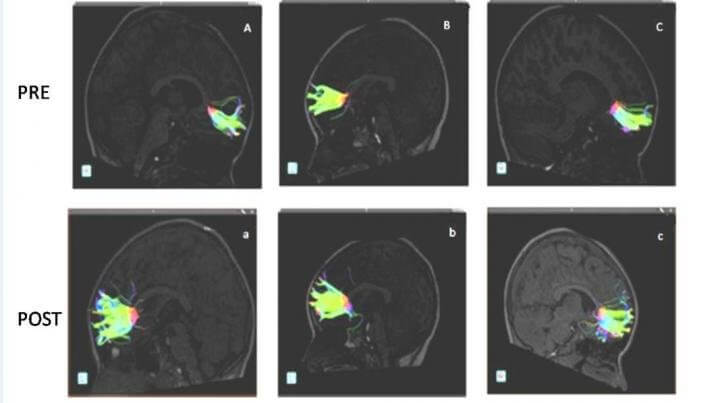 dti_brain_white_matter